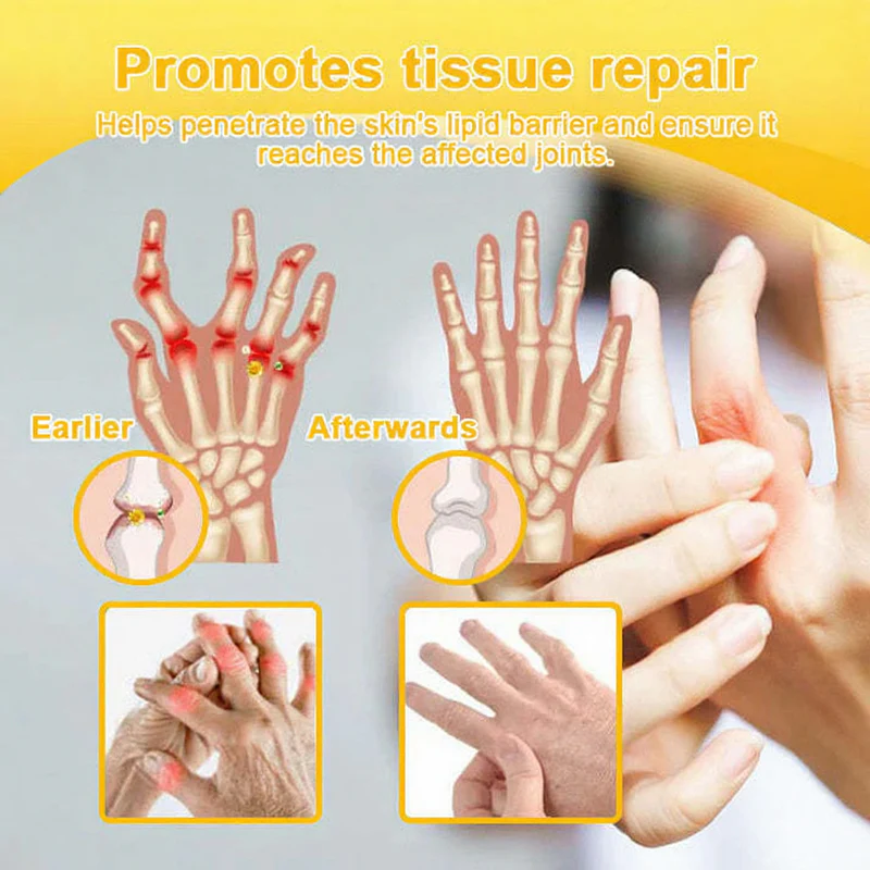 NovaRX®  Bee Venom Pain-Relief Joint Soothing Spray